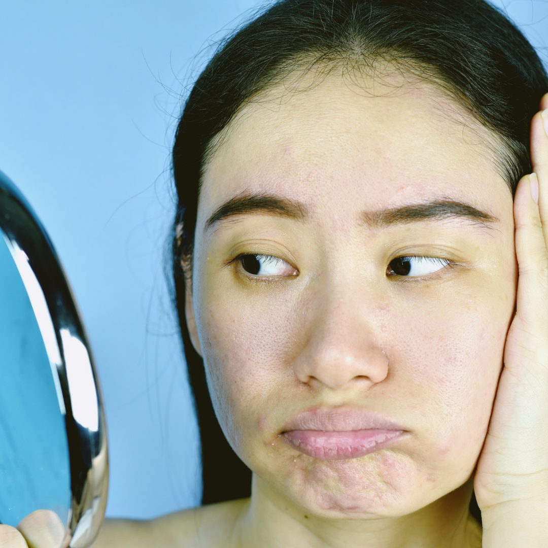4 Signs Your Skin Needs Attention And What To Do About It